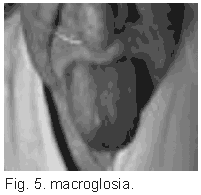 macroglosia.gif
